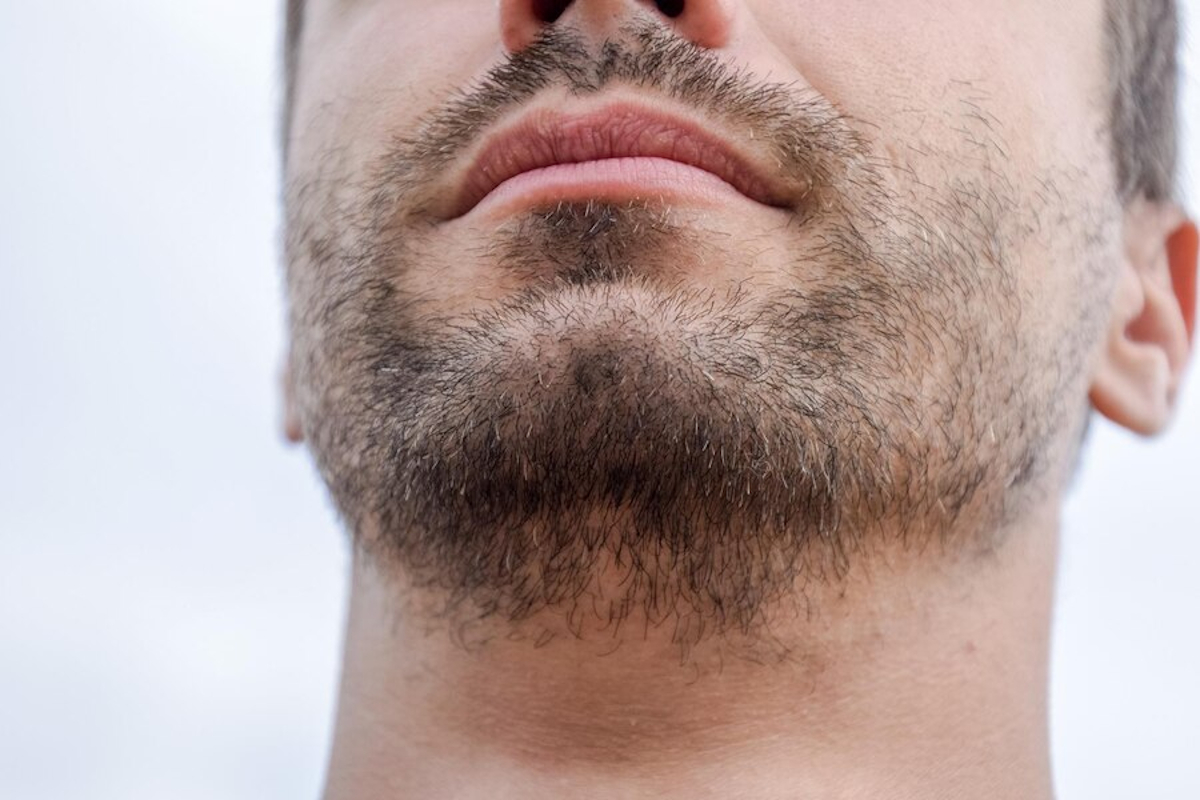 barbe après greffe